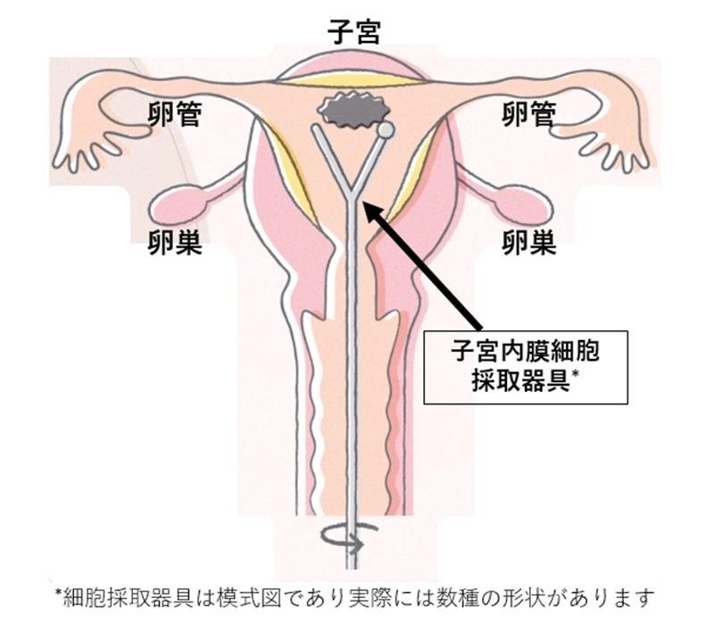 図：公益社団法人婦人科腫瘍学会ＨＰより一部改変
