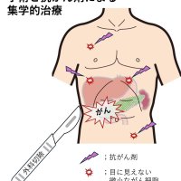 化学療法、再発少なく　微小細胞への効果期待　胆道・膵臓がん治療の進歩　千葉県がんセンター肝胆膵外科部長　賀川真吾　【９月はがん征圧月間　ちば　がんにうち克つ】（６）